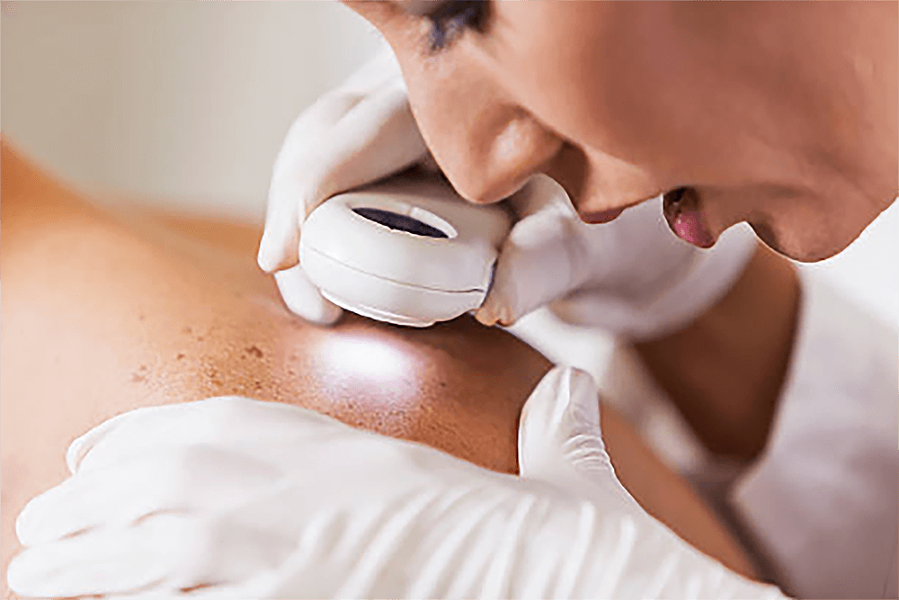 La dermatóloga examina la piel de un paciente masculino con dermatoscopio.